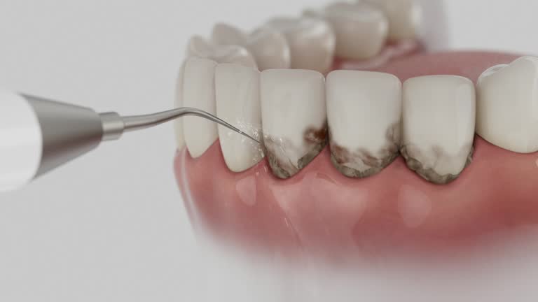 Trusted Tooth Extraction service in Marine, IL - Dentist Open Now